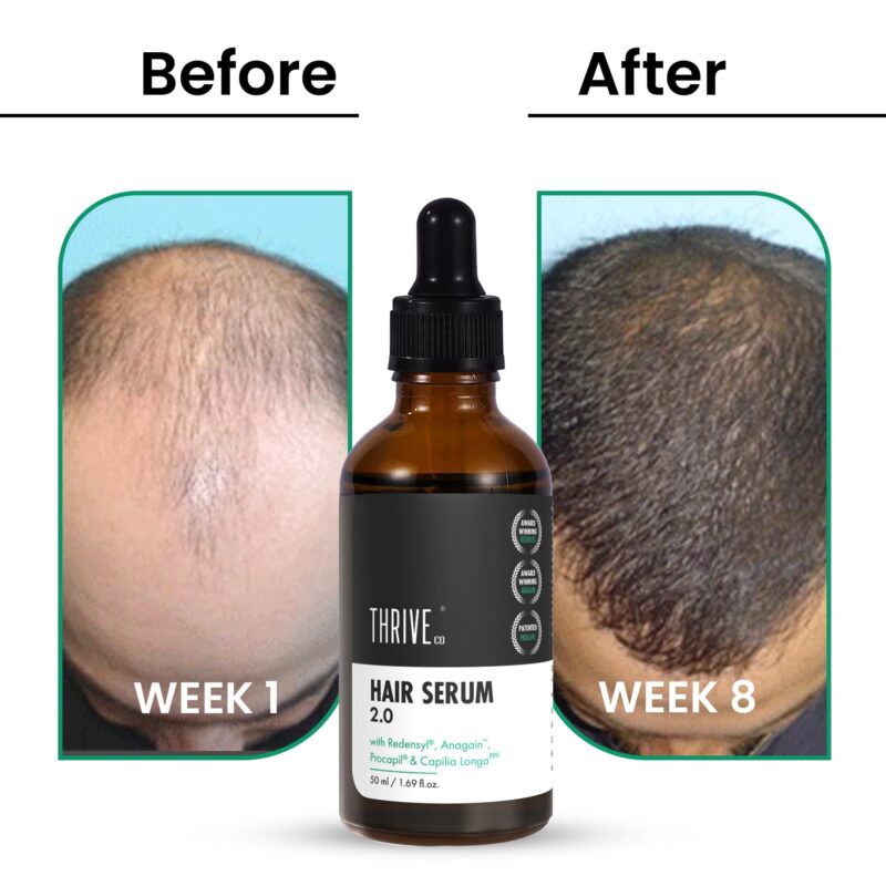ThriveCo Hair Growth Serum 2.0 For Hair Growth & Hair Fall Control | with Redensyl + Anagain + Rosemary + Procapil + Capilia Longa | For Men & Women | 50ml - Image 5