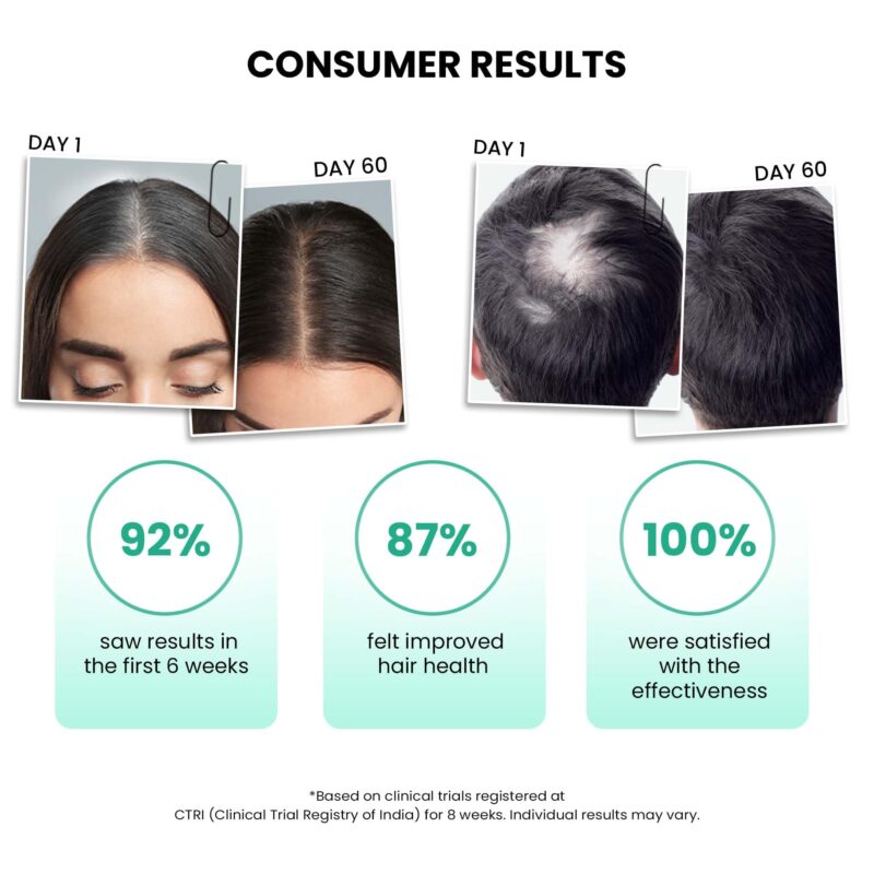 ThriveCo Anti-Grey Hair Prime Serum | Reverses & Limits Hair Greying | Arcolys + Biotin + Black Tea Extract | Light-Weight, Non-Sticky & Odourless | For Men and Women | 50 Ml - Image 6